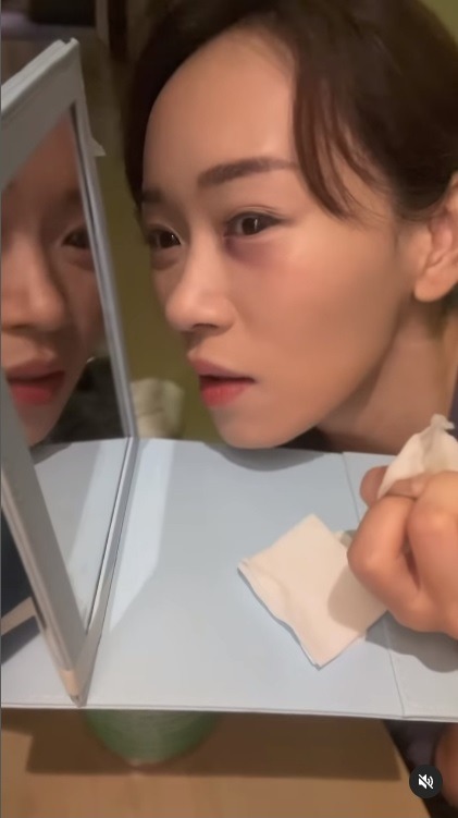 杨思琦“被掳”遭枪插眼 差1毫米就瞎！