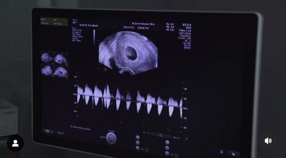 杨祐宁惊喜公开二宝超音波　笑喊：来自宇宙的声音