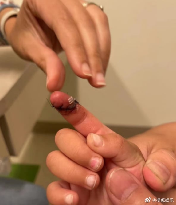 疯传郑爽被曝虐童 孩子严重到缝针