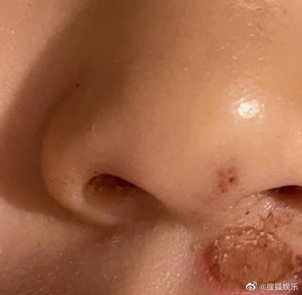 疯传郑爽被曝虐童 孩子严重到缝针