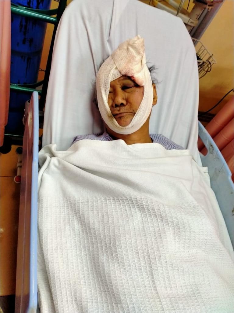 (古城封面主文)派报人遭撞后逃脑受创·家属呼公众提供资料