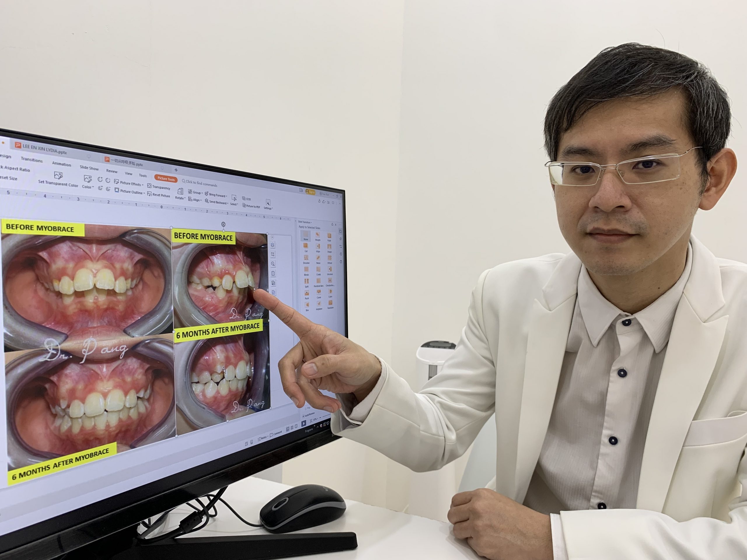 【特稿】:兔子可爱但兔牙却是不良习惯导致,牙医:及早纠正对孩童身心灵发展有益