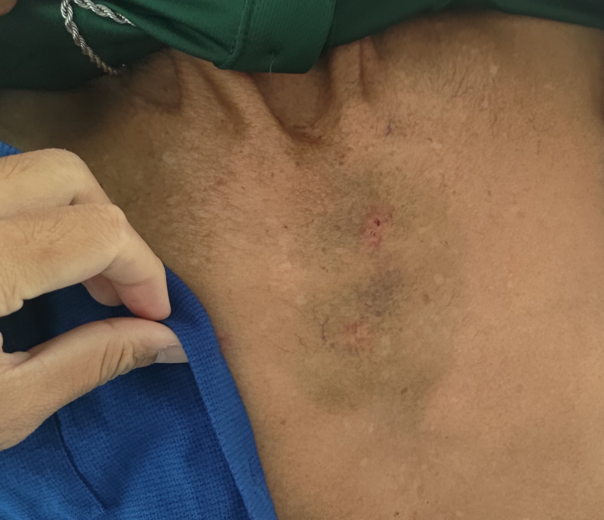 (大北马)私会党徒欲插队火化遗体怒打人,原来是寿板业者错报火化时间