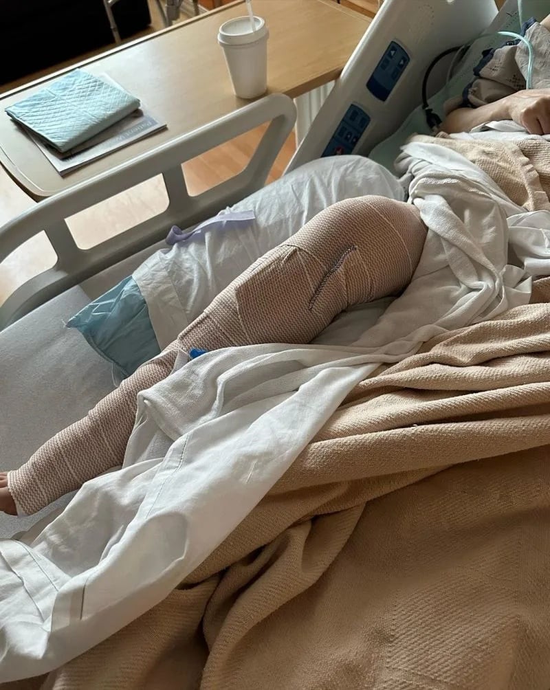 刘美君滑雪出严重意外 虚弱躺床喊:我会活下来