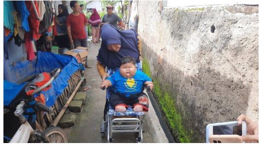 拼盘 尿布穿3XL!“16个月巨婴27公斤”超越8岁童