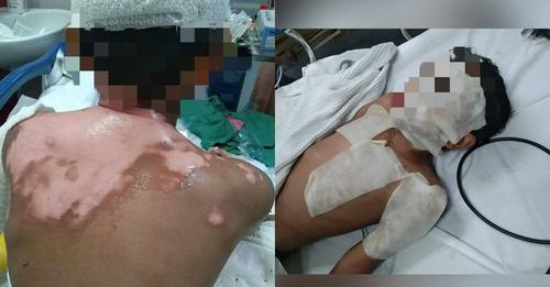 火碱通水管引爆炸|指肇事男施压求销案 伤者母亲不妥协:“我要为孩子讨回公道”