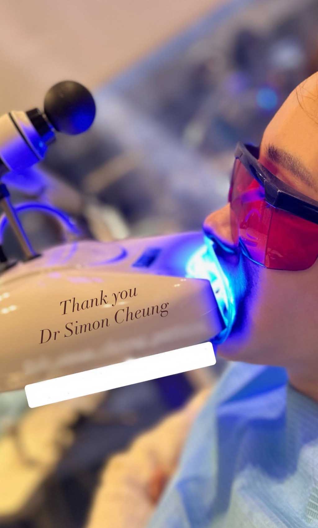 黎姿做牙齿美白  “满口血”吓坏网民