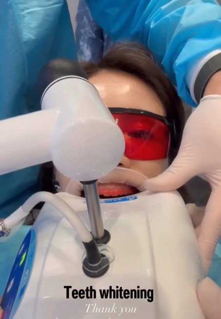 黎姿做牙齿美白  “满口血”吓坏网民