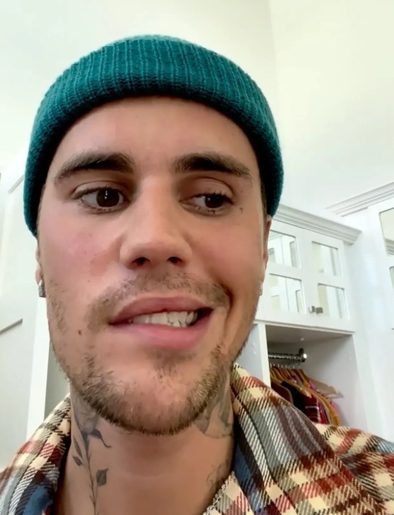 暴瘦面瘫病情严重 小贾斯汀取消巡唱养病