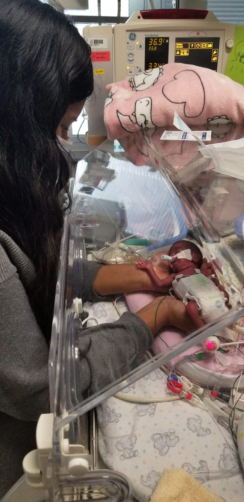 一度被医生告知零存活率 全球最早产龙凤胎1岁了