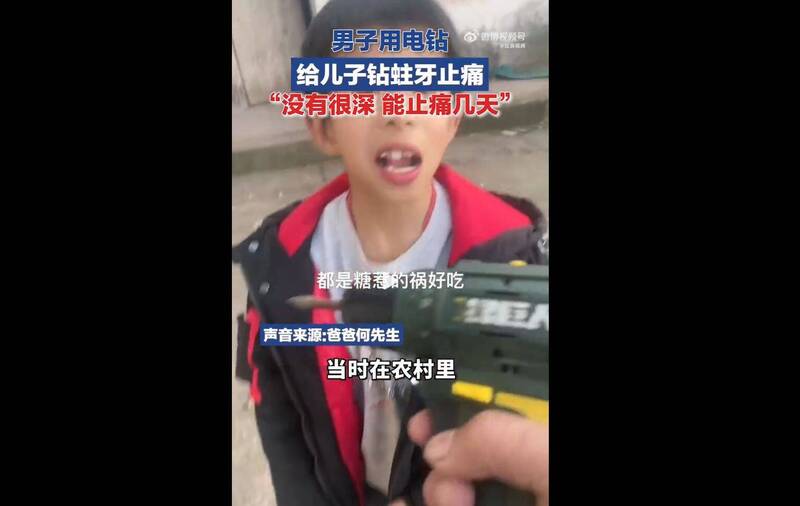 儿子蛀牙哀嚎 莽父竟拿电钻“止痛”:不会钻很深