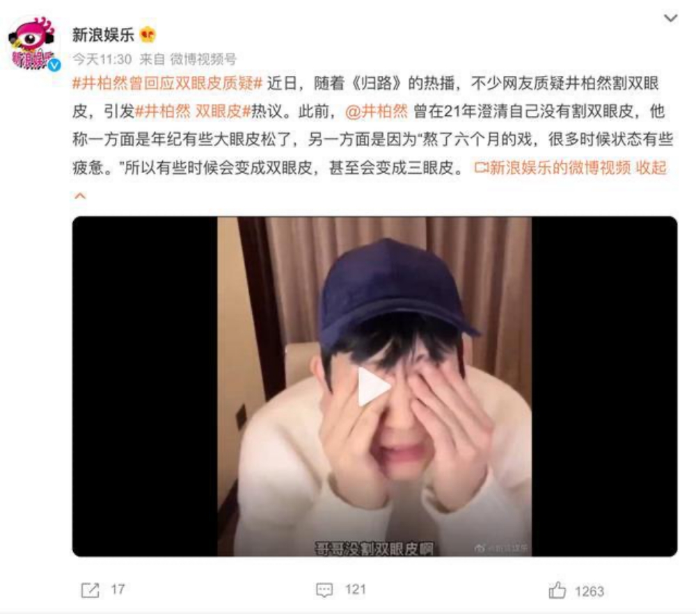 冒深遂双眼皮 井柏然整容？ 