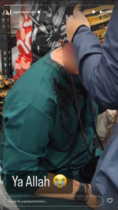 在新加坡被陌生人用斧头打中头部!本地男演员伤口撕裂严重