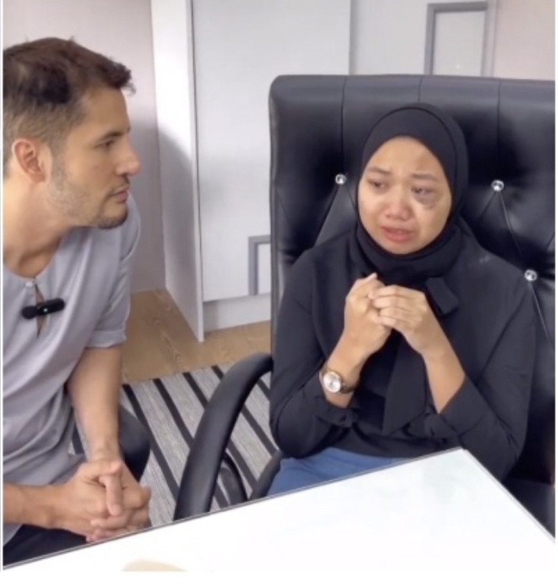 失婚又被演员丈夫打到破相·富商邀单亲妈当模特赚钱养子