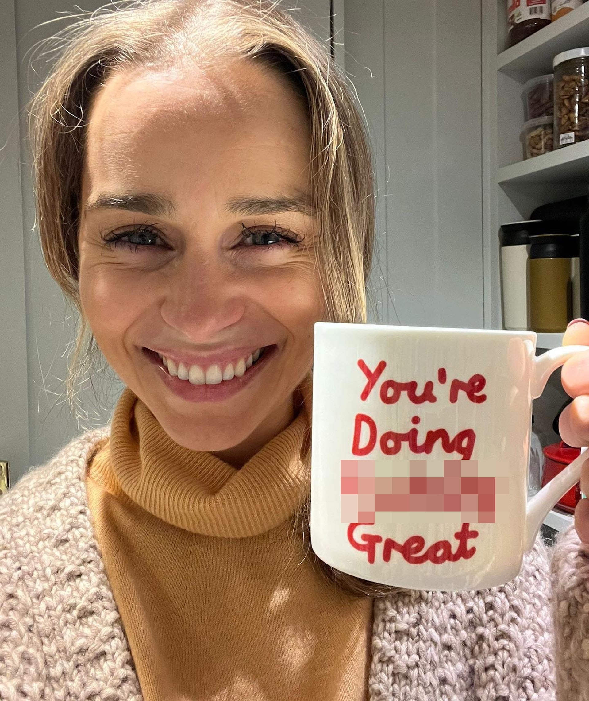 头顶微秃皱纹明显 艾蜜莉亚衰老近照惹议