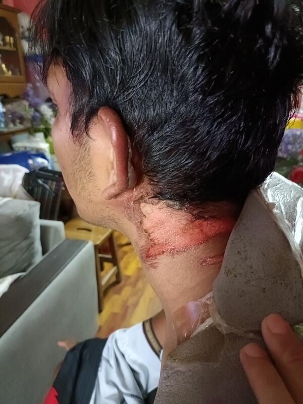 **已签发**柔:狮城二三事:女子涉热水泼夫后搭渡轮逃,被警拦截逮捕