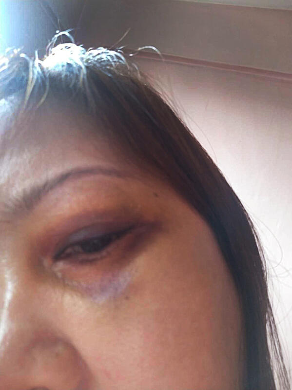 *已签发*柔:狮城二三事:疑拒玩赌花生 啤酒女遭两阿叔殴打