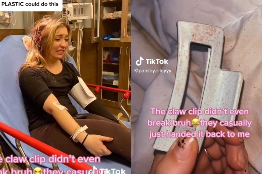 开车别戴鲨鱼夹!她车祸一摔竟被“刺穿头壳” 后脑杓喷血惨照曝