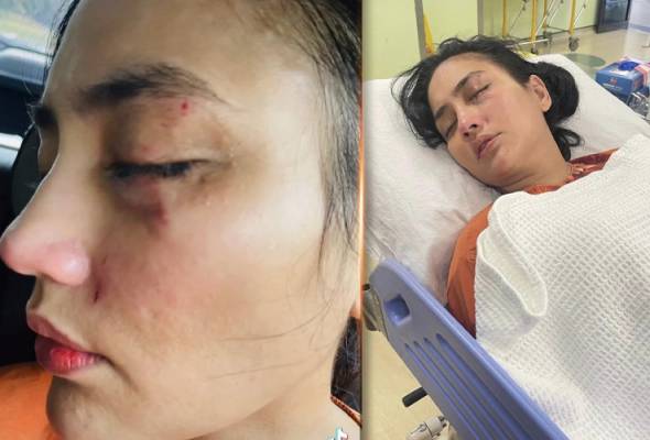 拍家暴戏份 女主假戏真做撞爆眼球