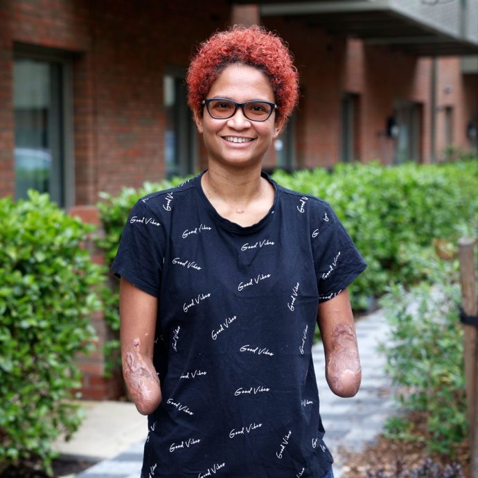 拼盘/被蚊子咬引发败血症!34岁女陷入昏迷 醒来发现四肢全没了