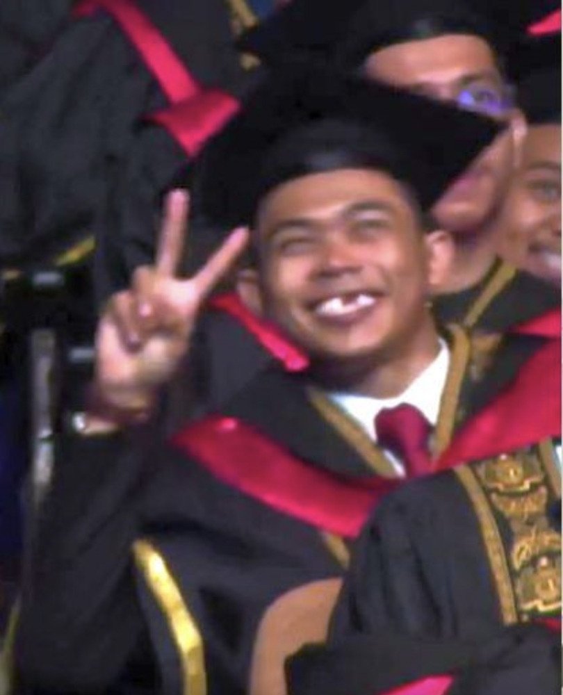 视频|毕业典礼3周前车祸断2门牙 男子露“无齿”笑容乐翻全场