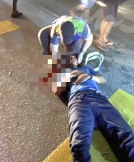 视频|毕业典礼3周前车祸断2门牙 男子露“无齿”笑容乐翻全场