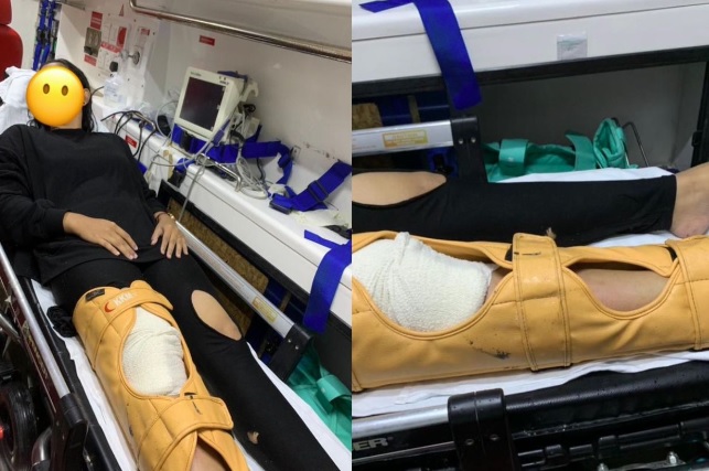 骑摩托被车撞致骨裂 少女:车主没车险 我不能索赔