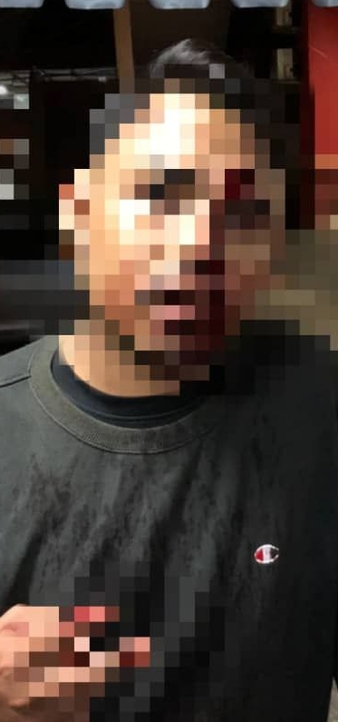 (古城版)疑拒绝手游惹祸 两名男子被殴打流血