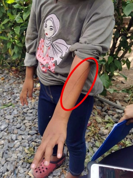 幼儿园教师发现新旧瘀痕,揭男童疑遭继父虐待,男童母自爆也是受害者