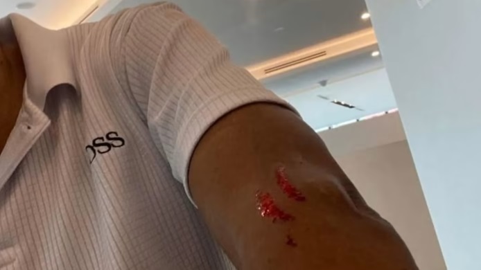 (已签发)柔:狮城二三事:疑不满绕远路 女乘客抓伤私召车司机