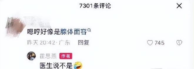 9岁嗯哼被疑患腺样体面容 霍思燕亲上线揭真相