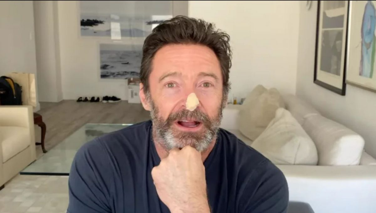 “金钢狼”晓治积曼皮肤癌疑复发 叹25年前没做这件事