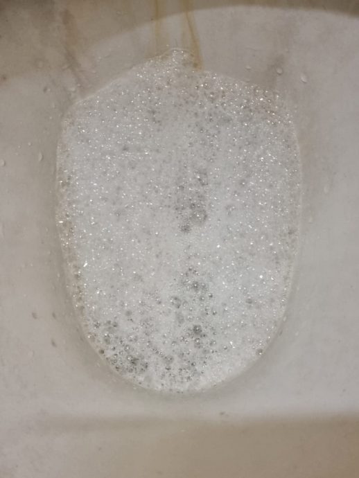 供星洲网/男子18年来受炎症困扰找不出病因，妻求政府认真关注提供帮忙