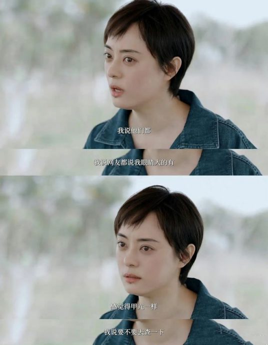 孙俪金鱼眼疑患甲状腺亢进  求救医生反挨骂