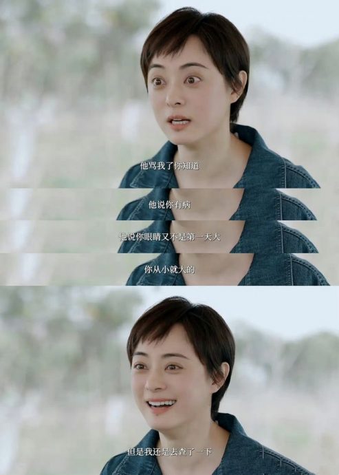 孙俪金鱼眼疑患甲状腺亢进  求救医生反挨骂