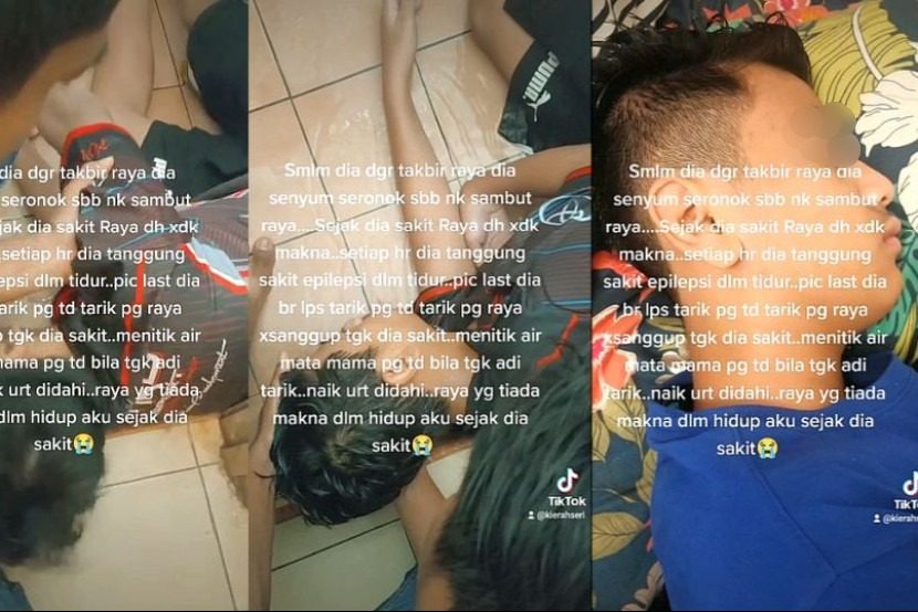 孩子癫痫症日益严重 母亲忧心会有一天失去孩子