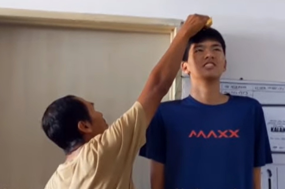 患罕见疾病 16岁少年身高198cm