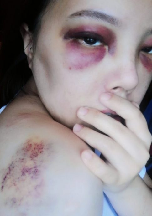 爱FM主播坐后座没绑安全带 车祸抛撞前座挡风镜