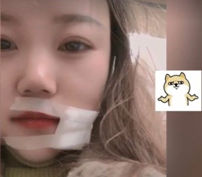 男甩竿竟「钓」到老婆！「鱼钩」插入脸颊　惊悚画面曝