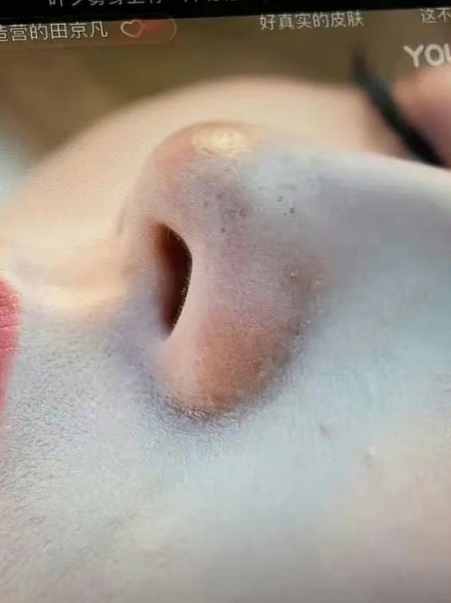 罗云熙瘦脱相被亏像骷髅 本尊上线求增胖食谱