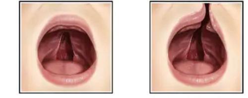 (大都会)为兔唇患者筹款