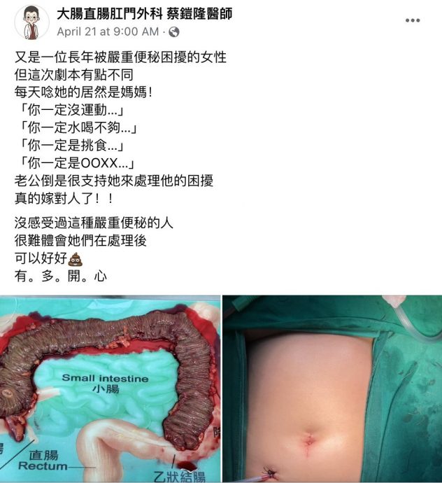 30岁女子每月只上一次大号!切除80%大肠终于“通了”