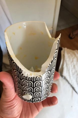 她看Tiktok学烹饪“微波炉煮鸡蛋” 下秒半边脸毁了