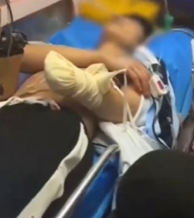 少年砍断主播手掌 起因只是口角纠纷