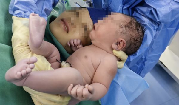武汉出现罕见“镜面人”宝宝 百万分之一几率“内脏左右相反”