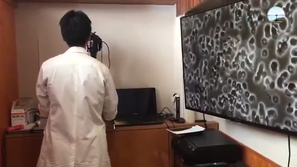 赤脚走在泥地有助血液循环？