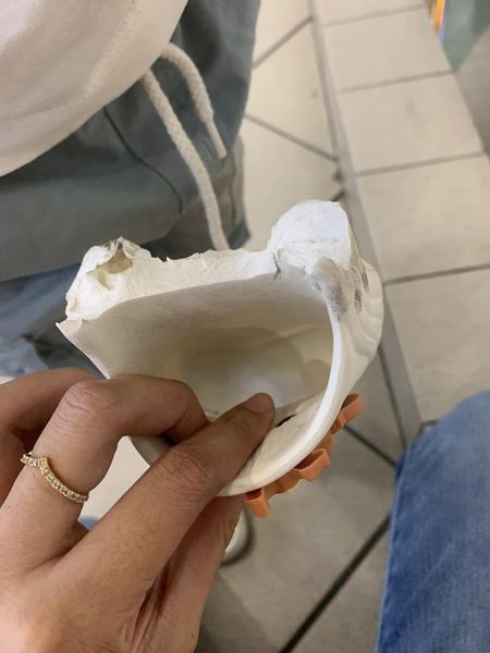 男童随母逛广场出事 塑料拖鞋被扶梯“吞”一半 