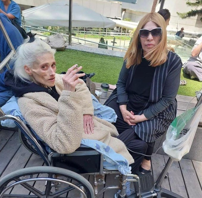 遭厌食症折磨13年 名模病逝体重仅23公斤