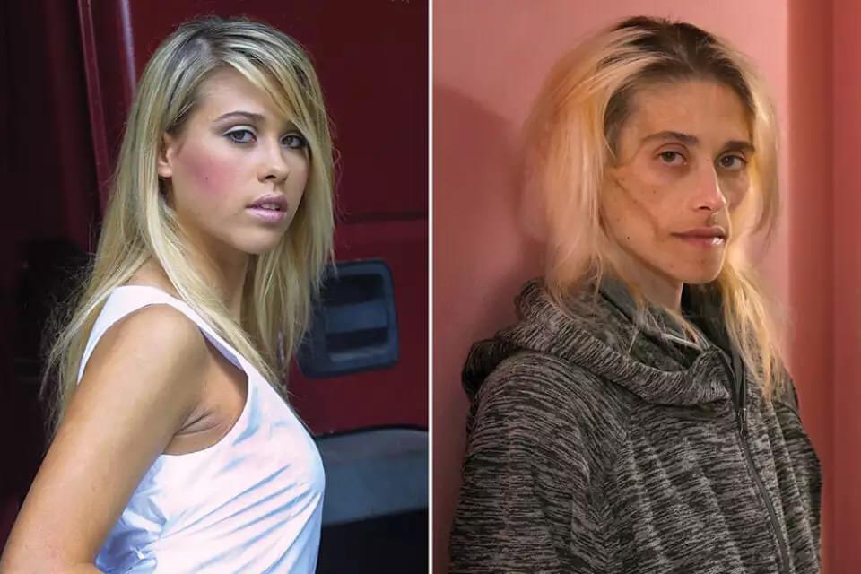 遭厌食症折磨13年 名模病逝体重仅23公斤