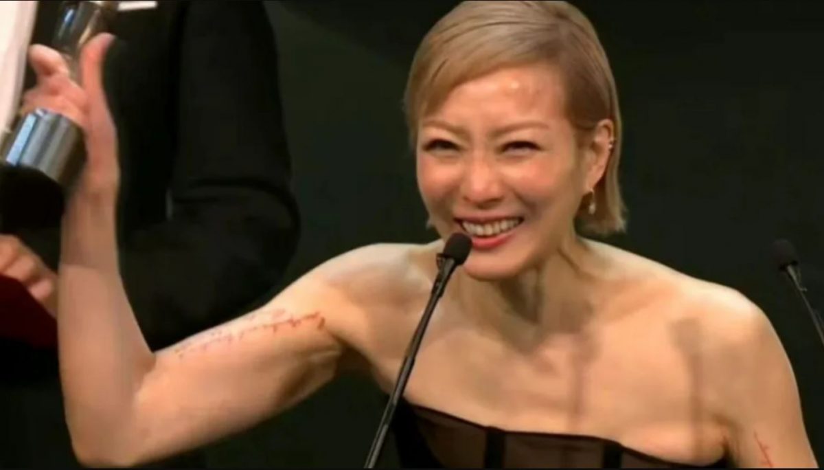 郑秀文夺后双臂被打码 网酸“好像被截肢”